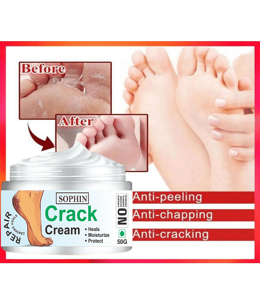SOPHIN Cracked skin repair Cream for ( 50 g ) view 2