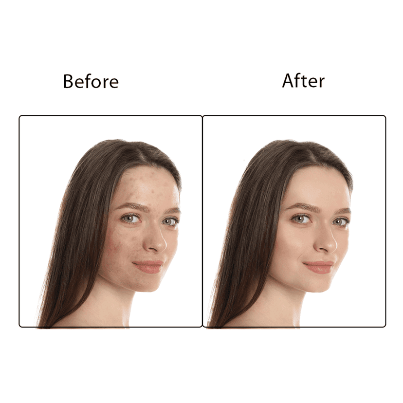 Spring H20 Charcoal Facial Kit 50 gm 2 in 1 Formula Brightening + Repair 5 Step view 5