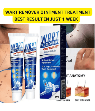 Massa Remover Cream for Warts Safely Painless Cream Skin Treatment