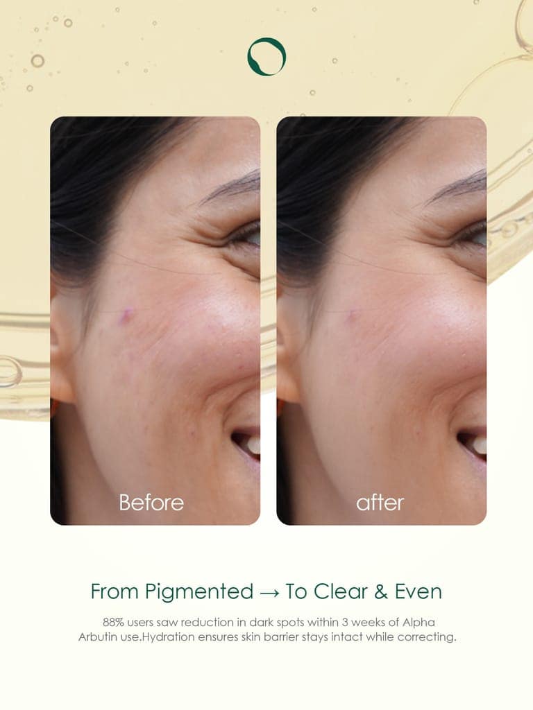 HERBLY™ Anti-Pigmentation Serum | 30 ml view 5