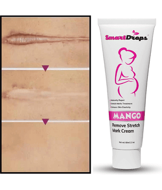 Smartdrops Light weight moisturising Cream Fruity ( 60 mL )