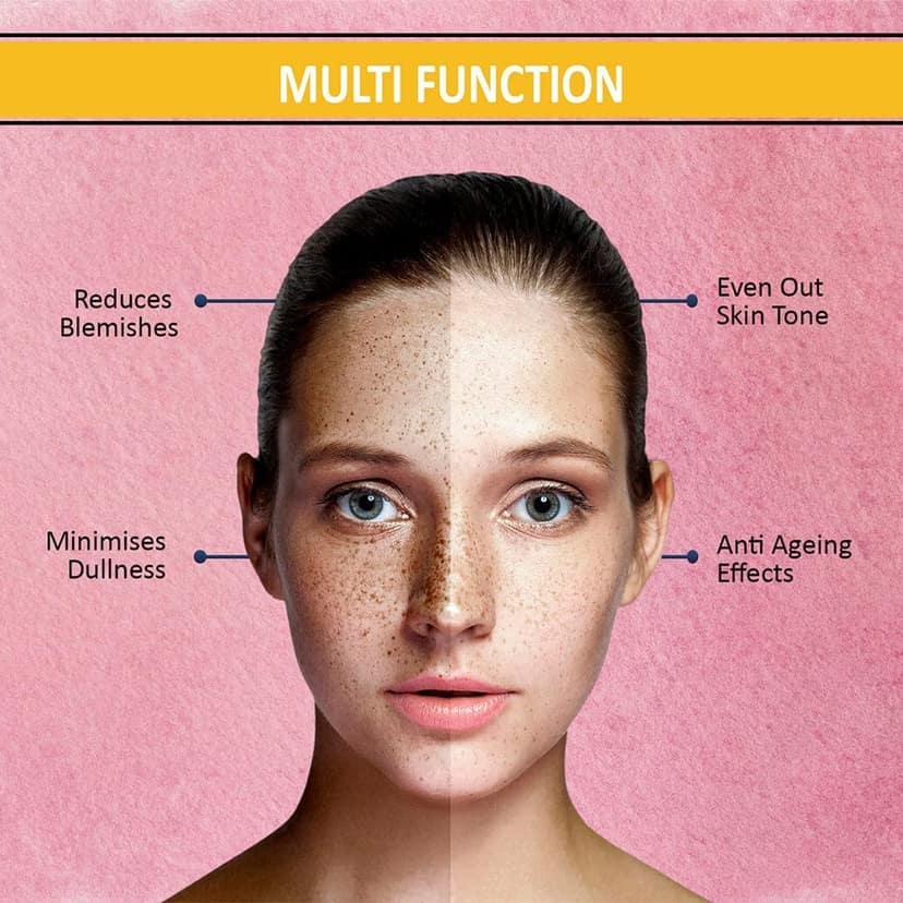 7 Days pigmentation Cream for Acne Scar Removal Pigmentation, Dark Spots & face Glowing (100 g) view 3