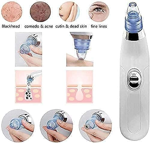Pore Cleaning Device with Vacuum Action Blackhead Remover view 2