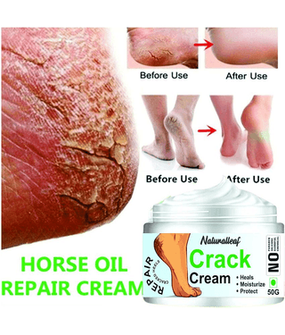 Naturalleaf Cracked skin repair Hand & Foot Cream ( 50 g )