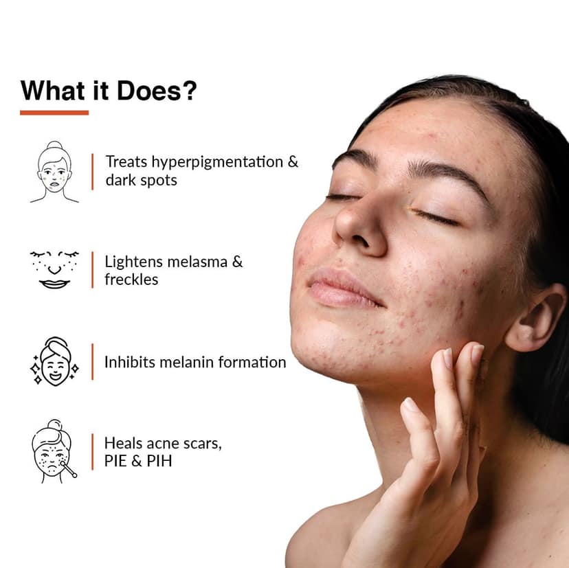Fixderma Skarfix-TX For Melasma Treatment view 2