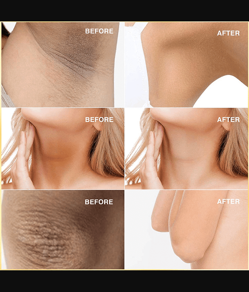 KURAIY Underarm Whitening & Brightening Cream For Remove Dark Underarm Black Spots view 2