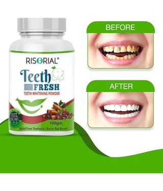 Risorial Teeth Whitening Denture Oral Kit