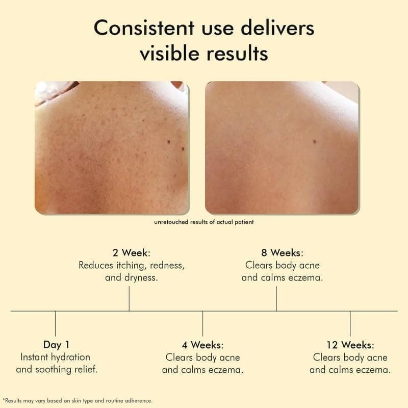 VEDICDERM Goat Milk Body Wash for Dry & Sensitive Skin | Natural Moisturizing Formula with Goat Milk, Aloe Vera & Shea Butter | Gentle Cleansing, Hydration & Nourishment view 2