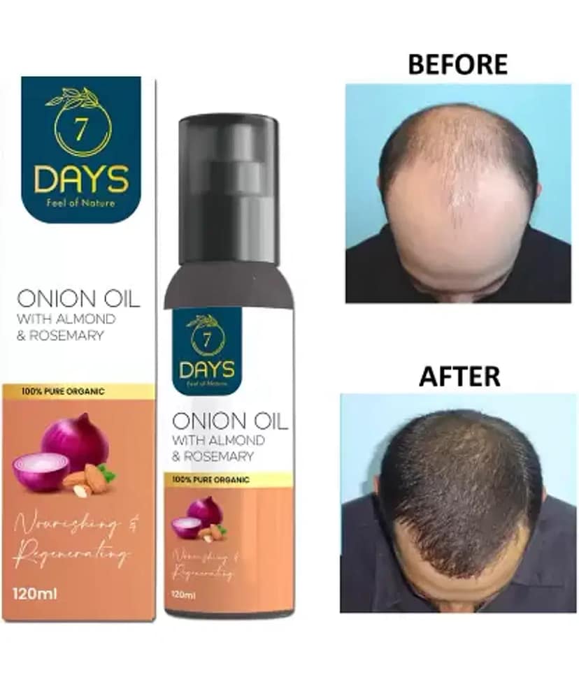 7 days - Anti Hair Fall Onion Oil 120 ml ( Pack of 1 ) view 2