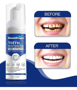 Smartdrops Teeth Whitening Denture Oral Kit