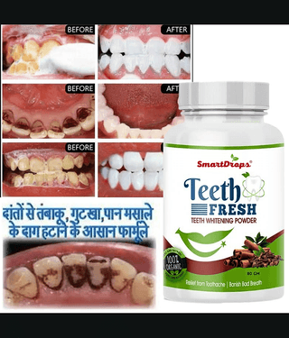 Smartdrops Teeth Whitening Powder