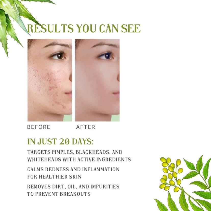 CAMISTA Anti Acne Face Wash with Neem & Aloe Vera Extract view 3