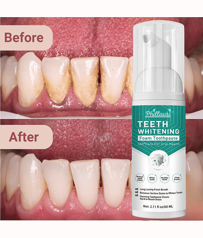 Phillauri Dentist Recommended Denture Oral Kit