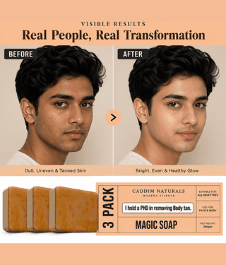 Caddim Naturals Skin Whitenings Bathing Bar For All Skin Type ( Pack Of 3 )