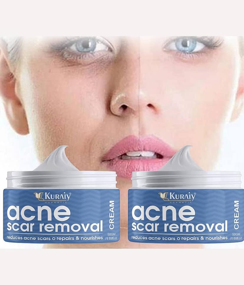 KURAIY Scar Removal Cream Repair Stretch Marks Burn Acne Scar Pack of 2