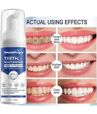 Smartdrops Dentist Recommended Denture Oral Kit