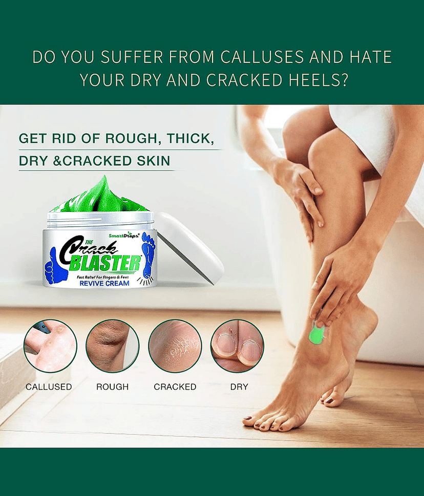 Smartdrops Softens For Dry & Cracked Feet Foot Cream Foot Cream ( 50 g ) view 2
