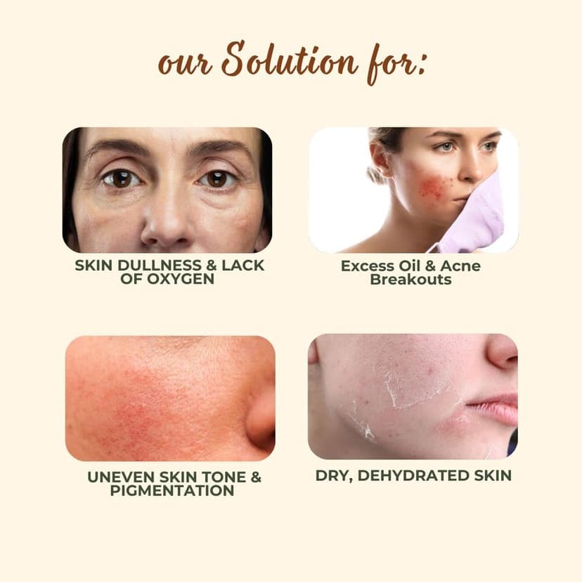 MrilQ Oxygen Face Pack | Pore, Acne & Oil Control | Daily Use | All Skin types (pack of 2) view 6