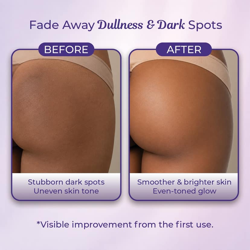 Sanfe Back & Bum Lightening Cream - 100g view 2