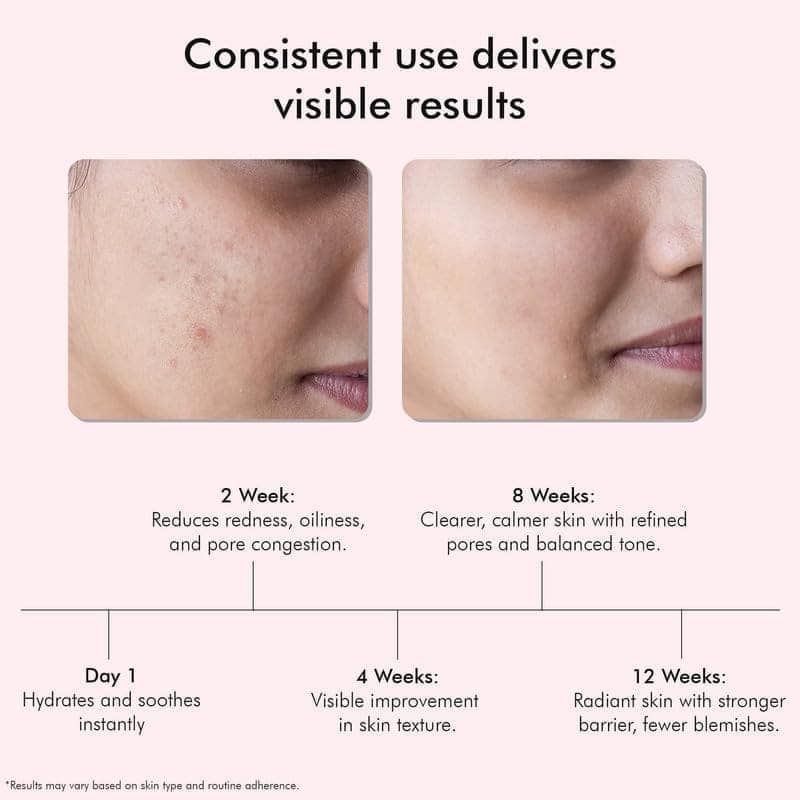 VEDICDERM Red Vine Deep Facial Cleanser 100ml | pH-Balanced Face Wash For Acne, Rosacea, Eczema, Aging & Sensitive Skin | Ceramides & Peptides For Barrier | Sulfate, Paraben & Alcohol-Free (Pack of 1) view 2
