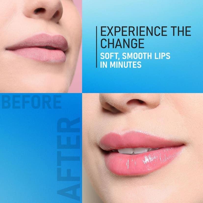 Yuthika Soft Touch Lip Care, Intense Moisture Lip Balm, Lips Moisturizing Balm 10 Gram Pack of 6 (Blister Pack) view 7