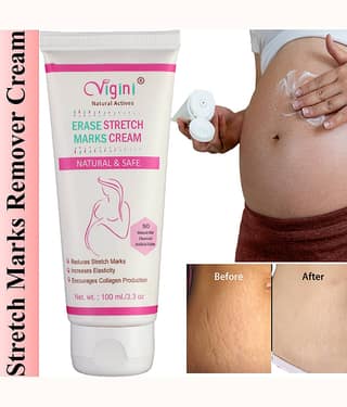 Vigini Natural Stretch Marks Removal Cream for Skin Tightening Shaping & Firming Cream 100 g