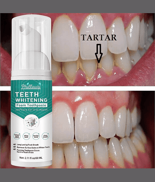 Phillauri Natural Standard Oral Kit