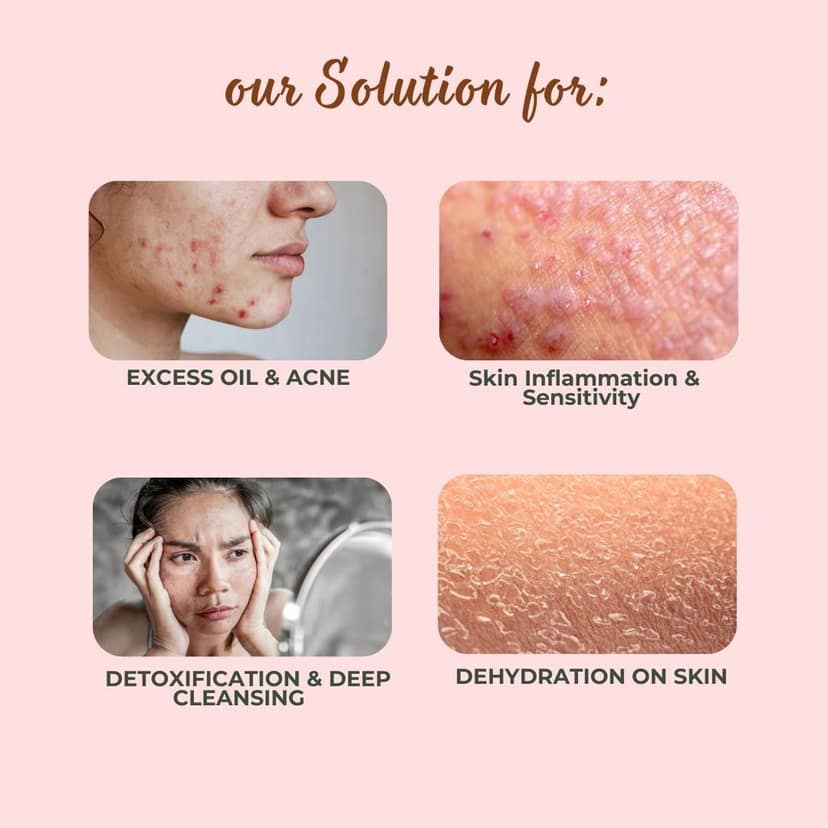 MrilQ Dusk Face Wash | Acne, Pimple & Oil Control | Daily Use | Sensitive, Oily, Combination skin view 6