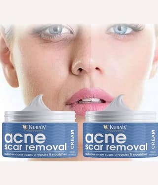 KURAIY Scar Removal Cream Repair Stretch Marks Burn Acne Scar Pack of 2