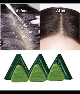 Treszo Beauty Seven Green Shampoo Bar Soap for All Skin Type ( Pack of 3 )