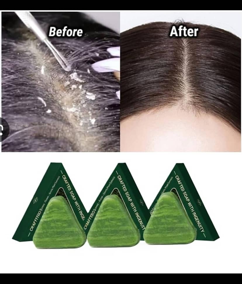 Treszo Beauty Seven Green Shampoo Bar Soap for All Skin Type ( Pack of 3 )