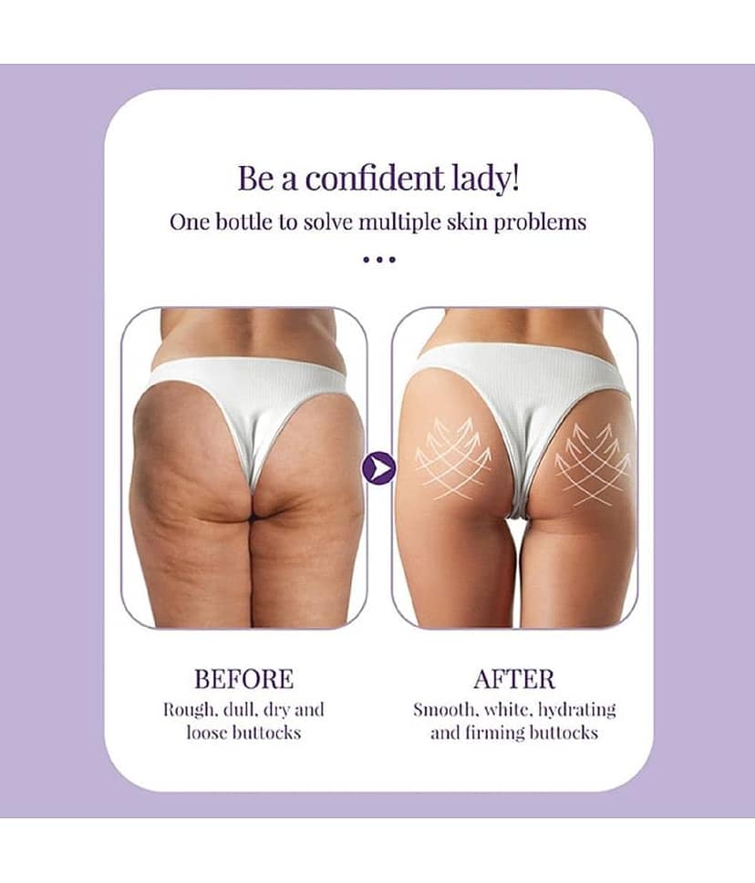 KURAIY Hips Enlargement Cream Effective Hip Lift Up Compact Tighten Body Care Pack Of 3 view 2