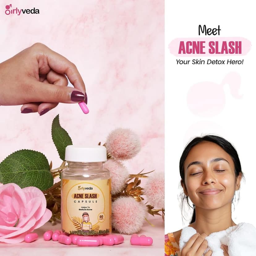 Girlyveda Anti‑Acne Ayurvedic Capsules (60) – Herbal Blood‑Purifier for Clear Skin, Acne, Pimples & Dark Spot Removal” view 3