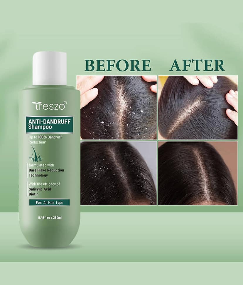 Treszo Anti Dandruff Shampoo & Conditioner 250 ml ( Pack of 1 ) view 2
