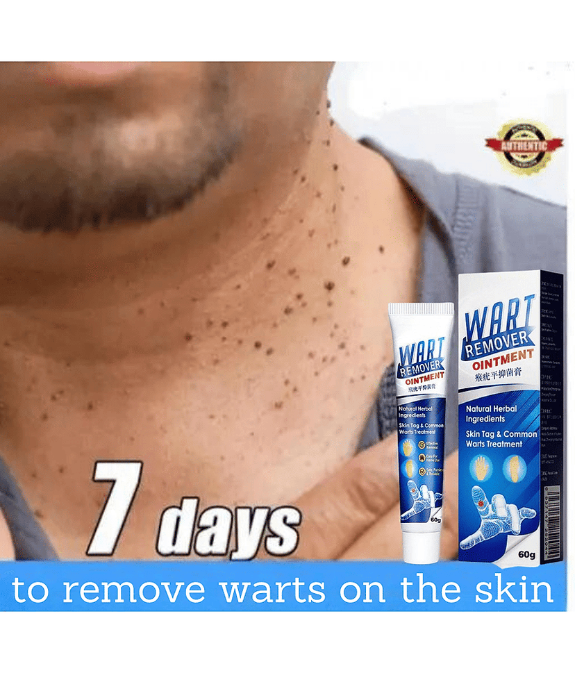 Remover Wort Without Leaving scars and refuse to repeat All Skin Type Use For Men And Women