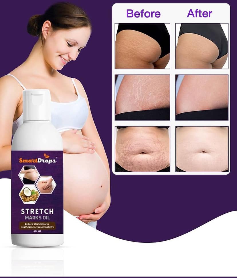Smartdrops Smartdrops Stretch Mark Remover Shaping & Firming Oil 60 mL - Pack of 3 view 2