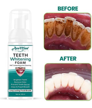 Aromine Teeth Whitening Foaming Mouthwash Liquid Mint 60 g