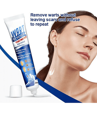 Wart Removal Ointment Treatment for Remove Warts Moles & Acne Safely Painless
