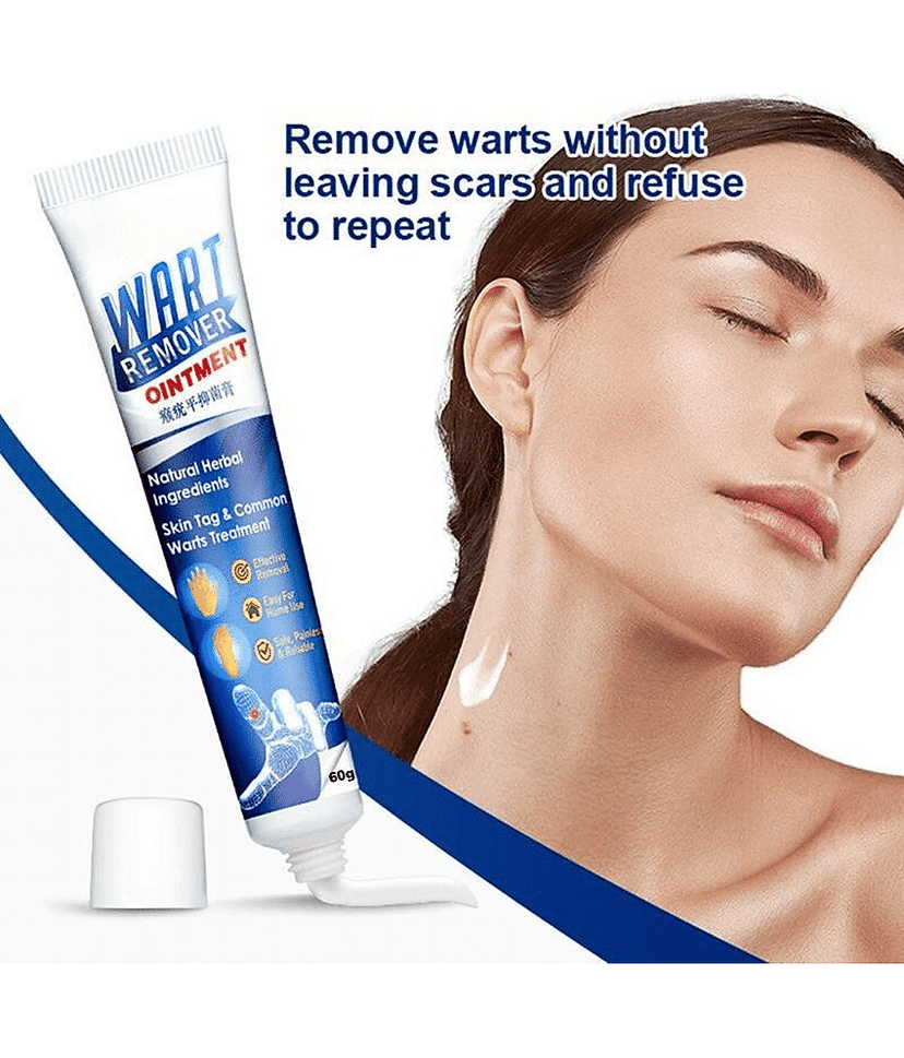 Wart Removal Ointment Treatment for Remove Warts Moles & Acne Safely Painless