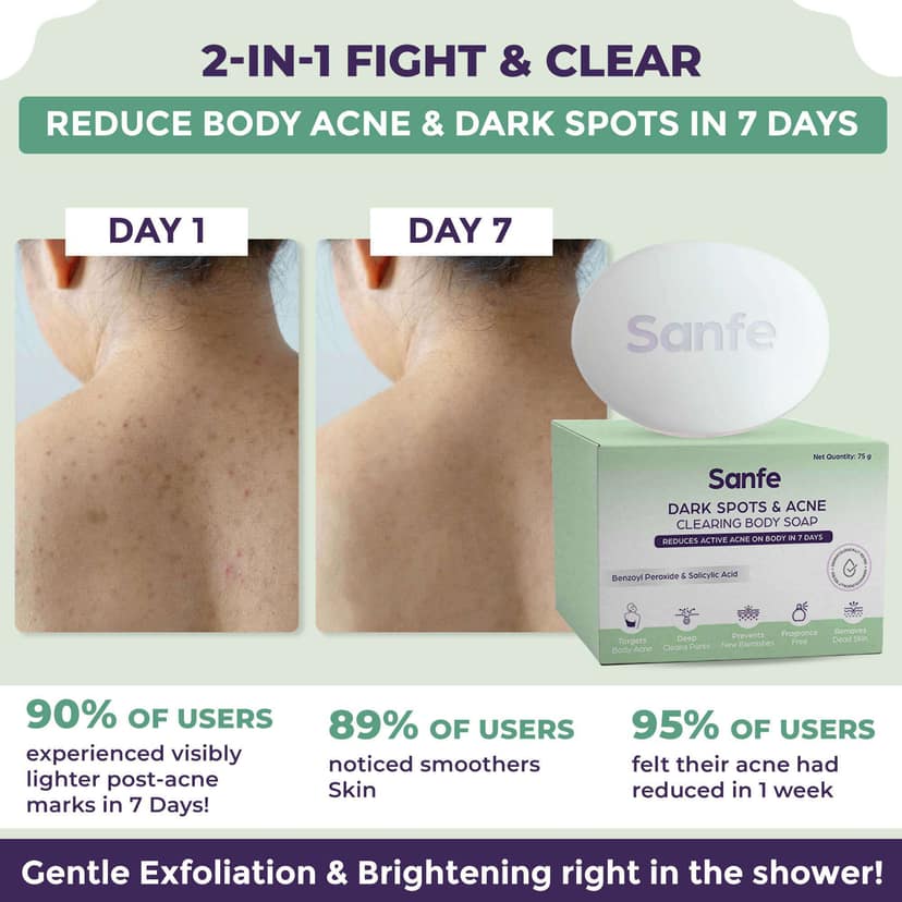 Sanfe Dark Spots & Acne Clearing Body Soap, 75gm view 2