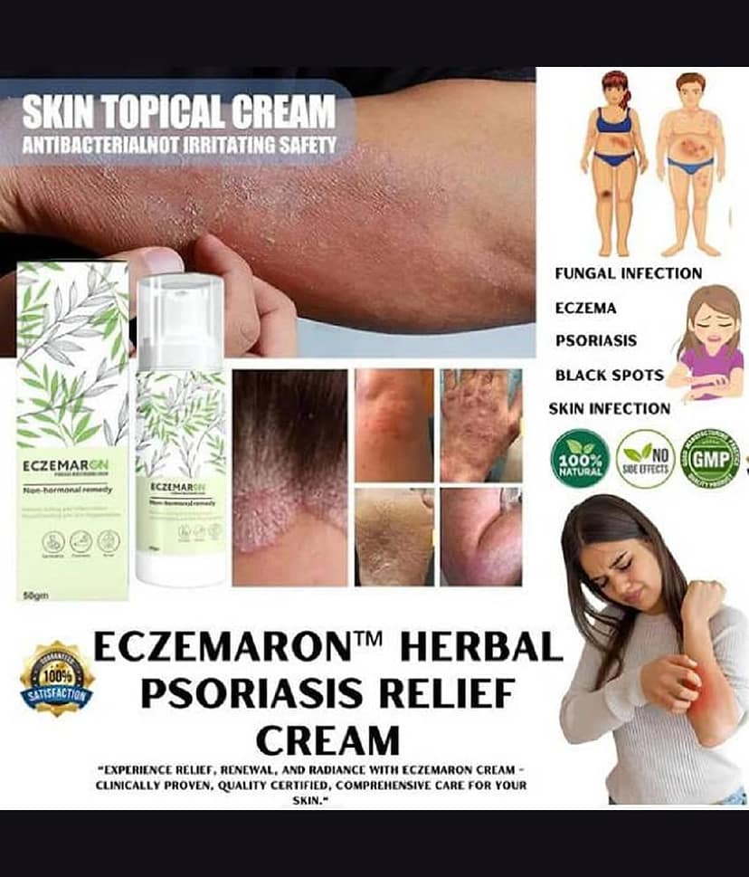 Eczemaron Herbal Anti Fungal Cream For Men & Women 50ml