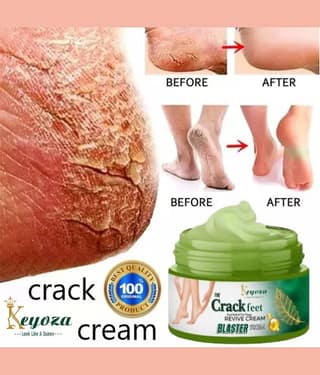 Keyoza Skin repair Cream for Summer ( 50 g )