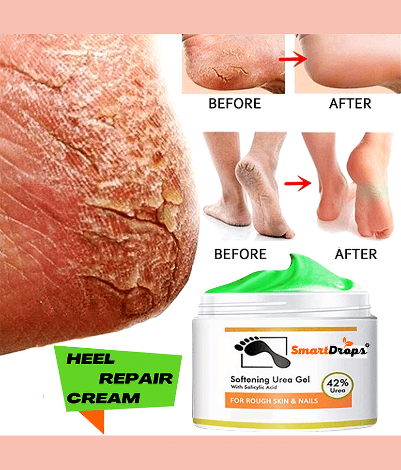 Smartdrops Smartdrops Foot Cream SPF 24 ( 50 g )