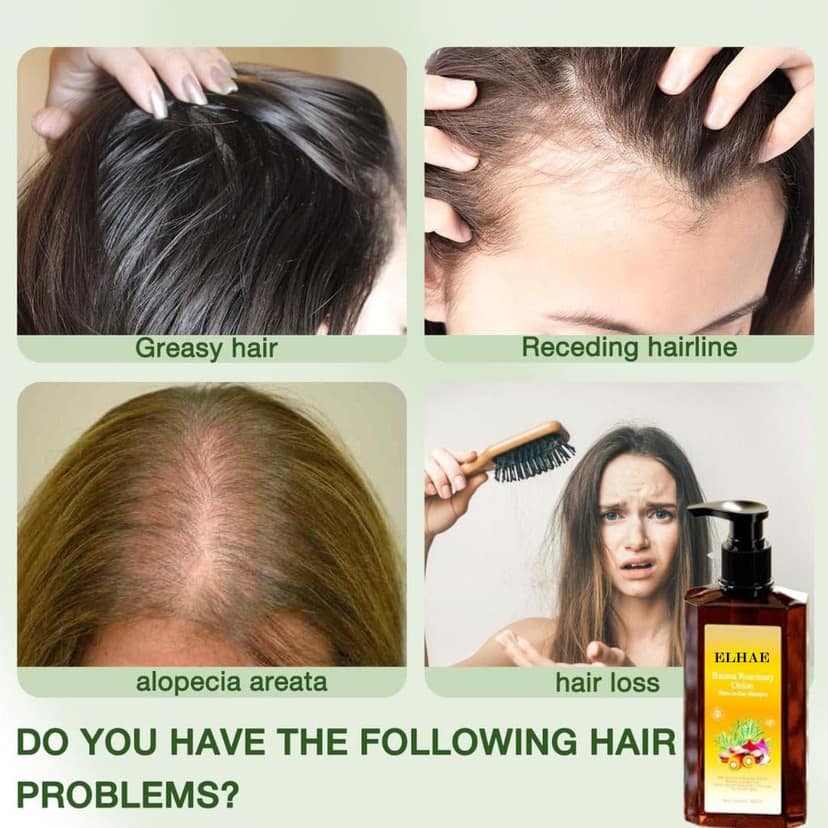 ELHAE 3 in 1 Batana Rosemary Onion Shampoo | Natural Hair Repair Formula | Reduces Hair Fall, Strengthens Roots & Moisturizes Scalp | For All Hair Types | Sulfate-Free, Paraben-Free view 8