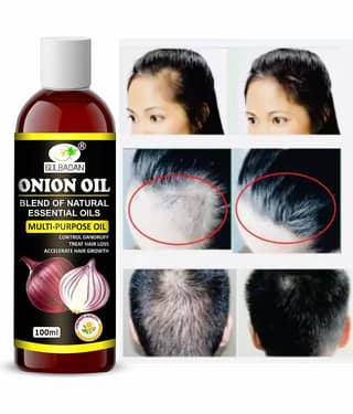 GULBADAN Anti Dandruff Onion Oil 100 ml ( Pack of 1 )