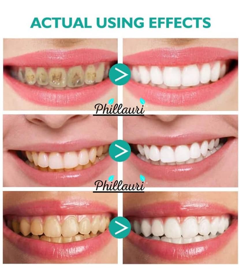 Phillauri Paraben Free Standard Oral Kit view 2
