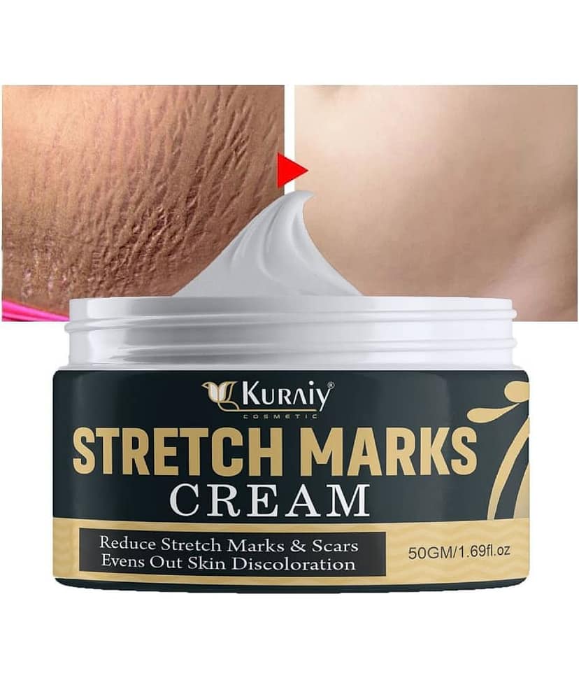 KURAIY Remove Pregnancy Mark Body Cream Treatment Scars Acne Stretch Marks Cream