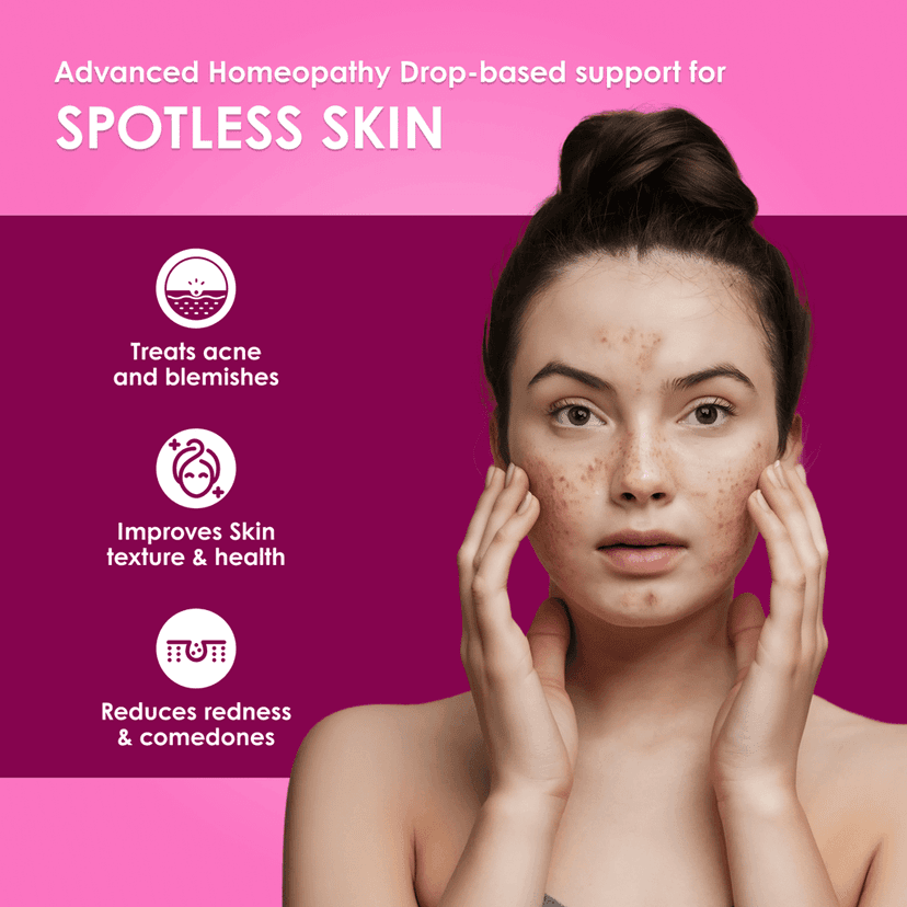 Meethi Golee Acnedonna Drops for Acne & Pigmentation Support (30ml) | Advanced Homeopathy 2.0 Skin-Regulation Formula for Breakouts, Oil Balance & Post-Acne Marks | Fast Absorbing Oral Drops for Clear Looking Skin view 2