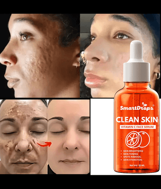 Smartdrops Face Serum Glycolic Acid Skin Toning For Sensitive Skin ( Pack of 1 )