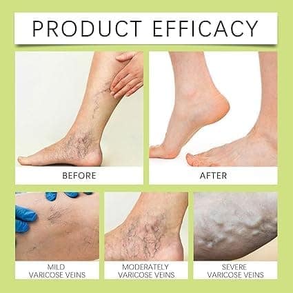 Miracle Balm Skin Moisturizing Balm | Multi-Purpose Soothing & Conditioning Daily Skin Care | Soft, Smooth & Comfortable Skin | 30g (Pack Of 1) view 2